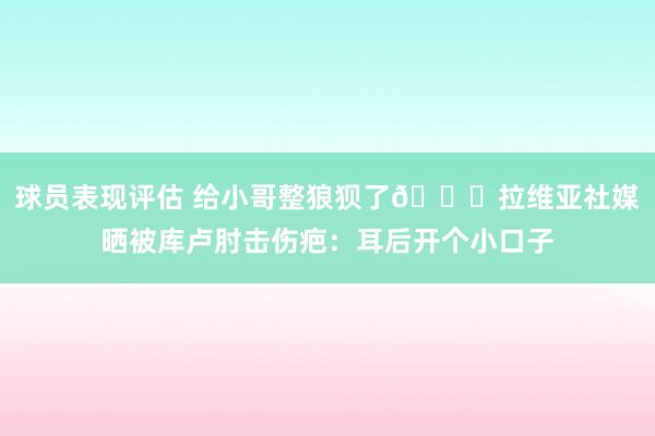 球员表现评估 给小哥整狼狈了😅拉维亚社媒晒被库卢肘击伤疤：耳后开个小口子